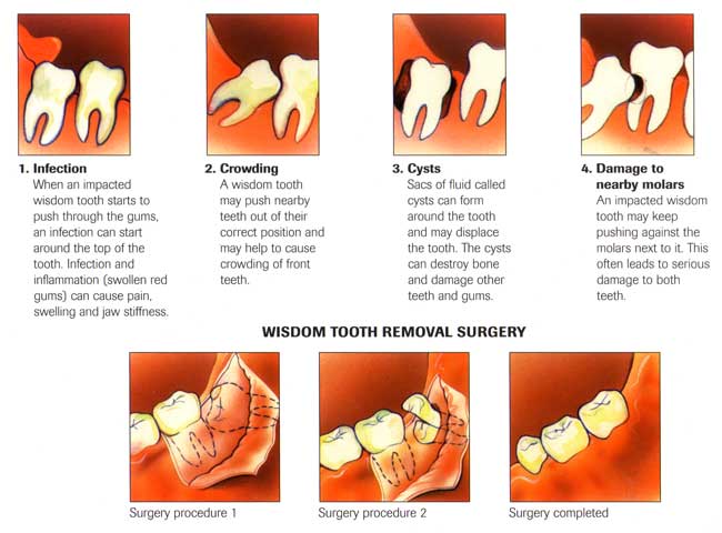 Oral Surgery Treatment Services