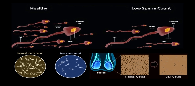 Low Sperm Count Treatment