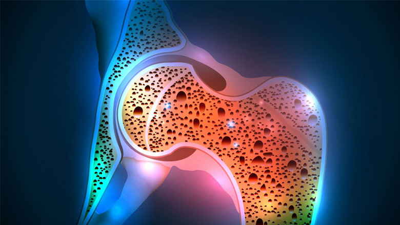 Osteoporosis Stem Cell Treatment Services