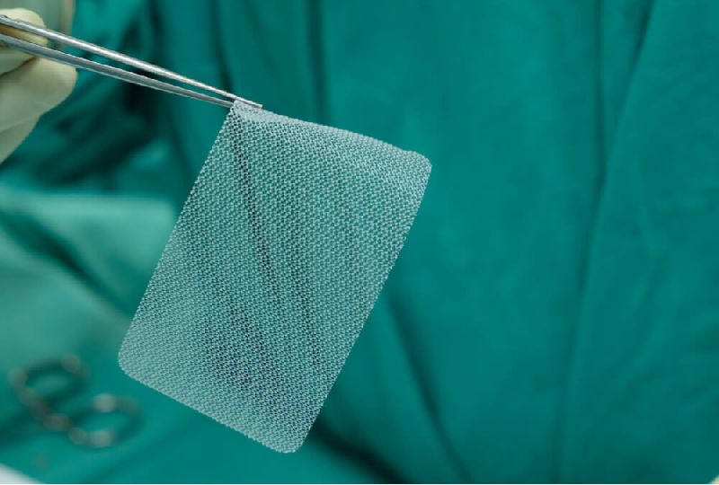 Soft Plastic Surgical Mesh, for Medical, Feature : Long Life, Recyclable