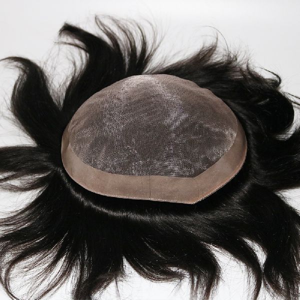 How Much Does A Hair Patch Cost in India? By PHC