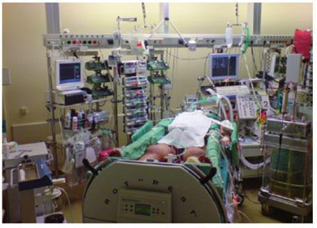 intensive care unit