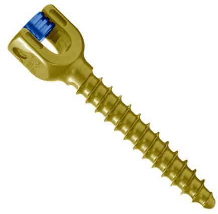 SMPL Titanium Sacral Screw, Length : 20 to 50 mm (5 Variation)