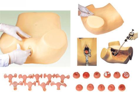 Gynecological Examination Model