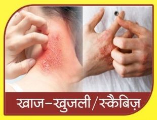Scabies Ayurvedic Treatment