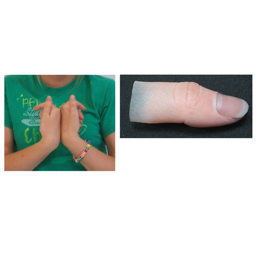 Silicone Finger Prosthesis, Packaging Type : Box