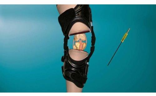 Osteoarthritis Knee Brace