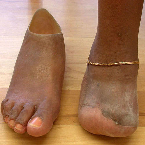 Cosmetic Foot