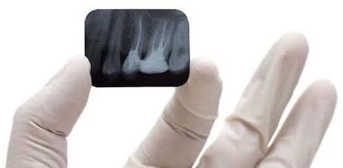 Dental x ray