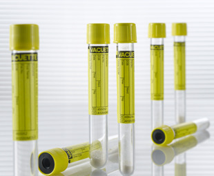 Urine Culture Tubes