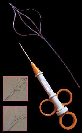 Zero-tip Nitinol Stone Basket