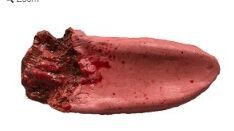 Speechless Tongue Prop