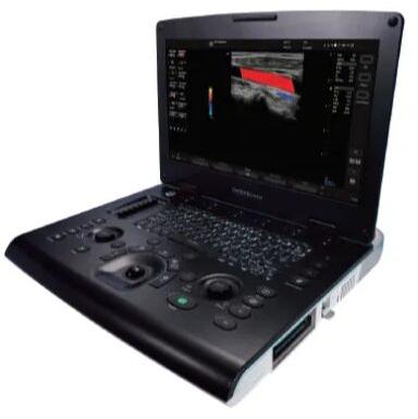 3D/ 4D GE Versana Active Ultrasound Machine