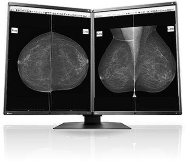 LCD Medical Monitor, Screen Size : 24 Inch