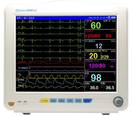 Pulse Oximetry Monitor