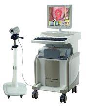 Gynecology Digital Electronic Colposcope