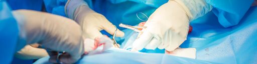 Adhesion Surgery in India