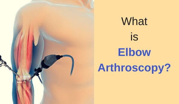 Elbow Arthoscopy Treatment