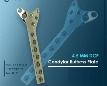 Condylar Buttress Plate