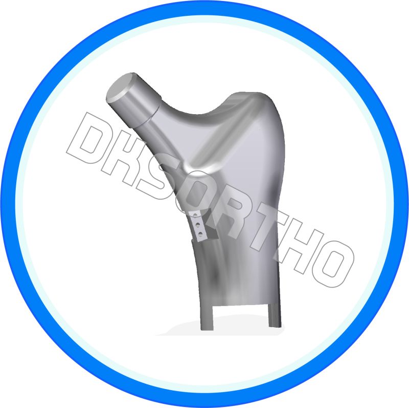 Grey Polished Proximal Femur Trochanteric Component, Size : Standard