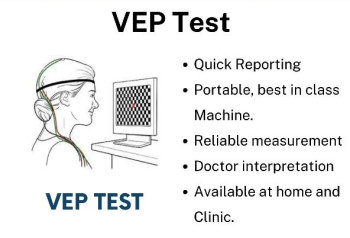 vep test service