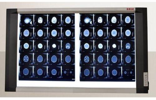 LED Double Film X-Ray View Box, for Veterinary Purpose, Hospital, Home Purpose