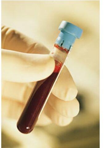 Plastic Blood Sugar Test Tube, Size : Standard