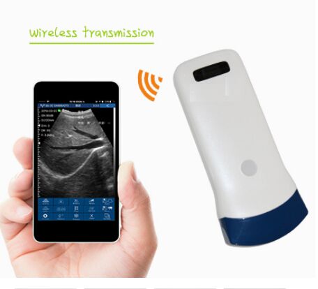 Wireless Color Portable Ultrasound Convex 3.5MHz SIFULTRAS-5.21