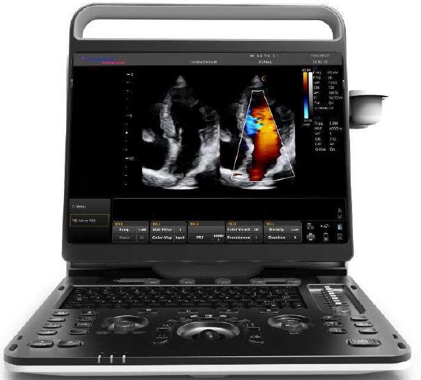 Portable Digital Color Doppler Ultrasound