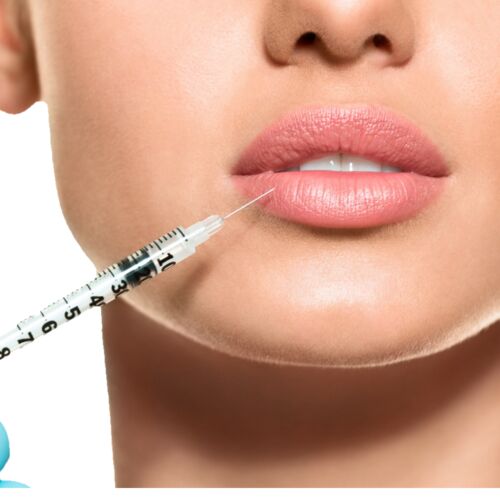 Fillers Treatment