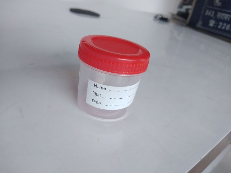 Sputum Collection Container