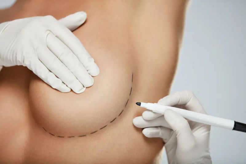 Breast Augmentation Surgery In Ahmedabad