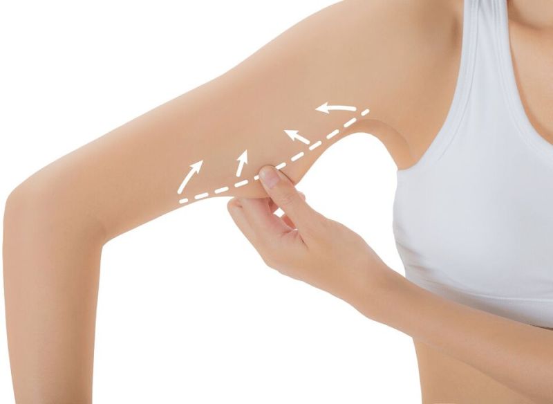 Liposuction Surgery In Ahmedabad