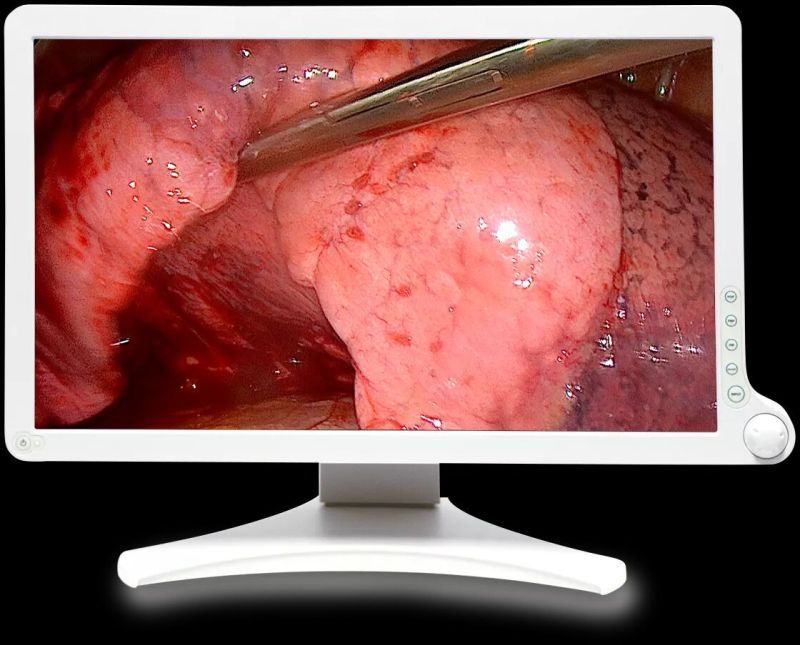 Amm 215WTD Surgical Display