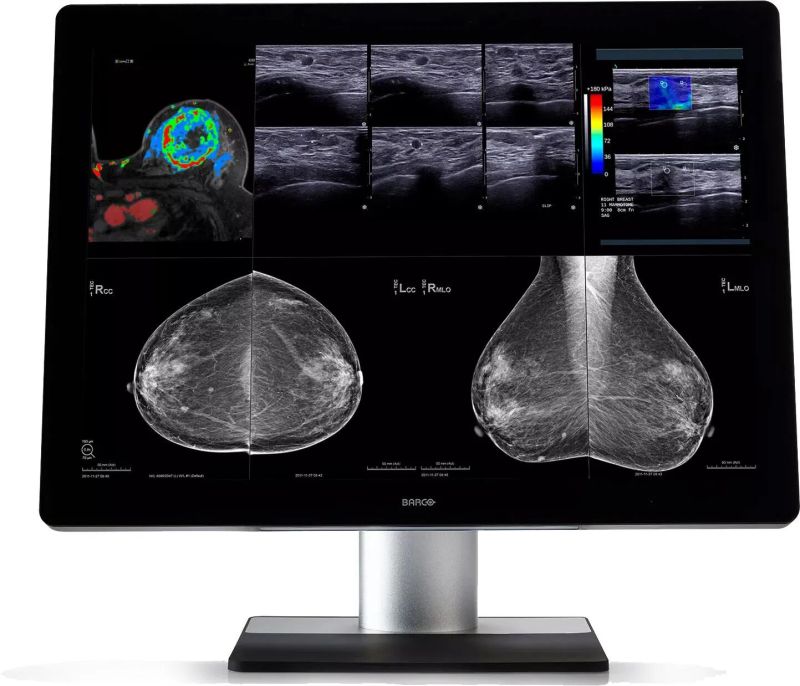 Coronis Uniti (MDMC-12133) Diagnostic Display
