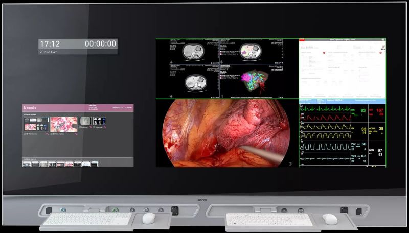 MDMX‑22449 Gntb  Surgical Displays