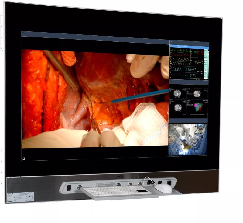 MDMX‑25500 Gnnb Surgical Displays