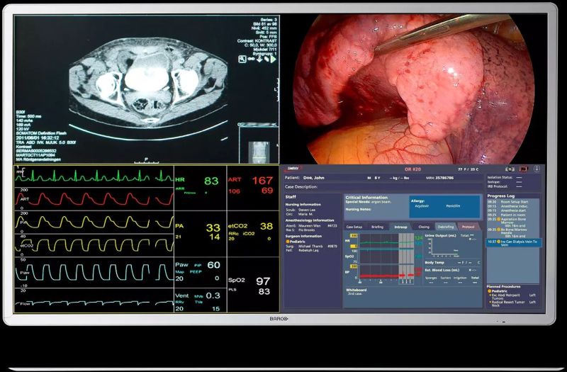 MDSC‑8255 Surgical Displays