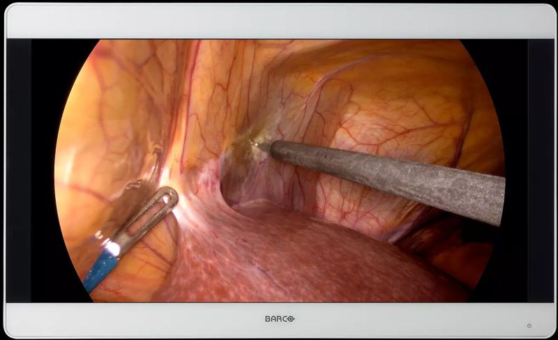 mdsc8527 Sstf Nxf Surgical Display