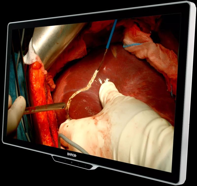 MDSC‑8532 Sstf / Nxf Surgical Display