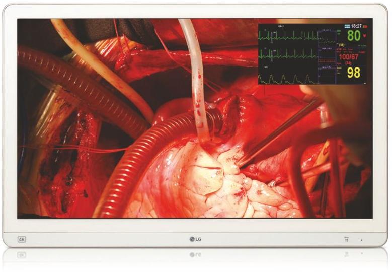 medical grade monitor