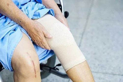 Knee Replacement Treatment Service