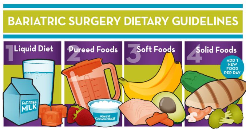 Bariatric Surgery Diet