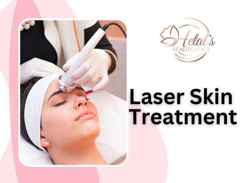 Laser Skin Treatment