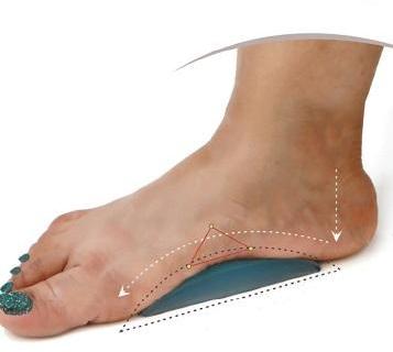 Blue Plain Silicon Hel Arch Support, for Medical, Feature : Optimum Performance, Reusable