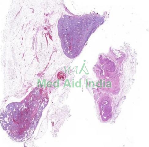 Plain Histology Slide Parathyroid Gland, for Clinical, Laboratory, Feature : Eco Friendly, Superior Quality