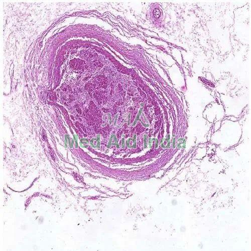 Plain Histology Slide Stomach, for Clinical, Laboratory, Feature : Eco Friendly, Superior Quality