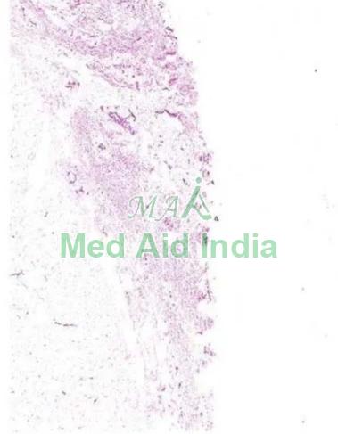 GLASS Plain Histology Slide Lung for Medical Teaching