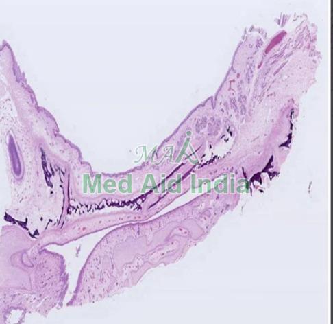 Oral Histology Hard Palate Fetal, for Clinical, Laboratory, Feature : Eco Friendly, Superior Quality