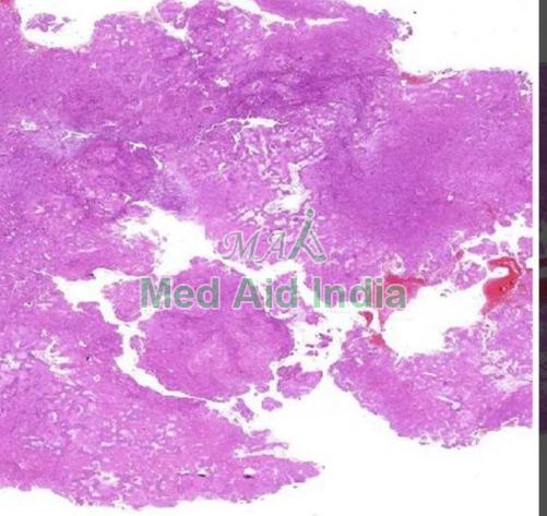 Transparent Rectangular Plain Oral Pathology Fibrous Dysplasia, for Clinical, Laboratory, Size : Standard